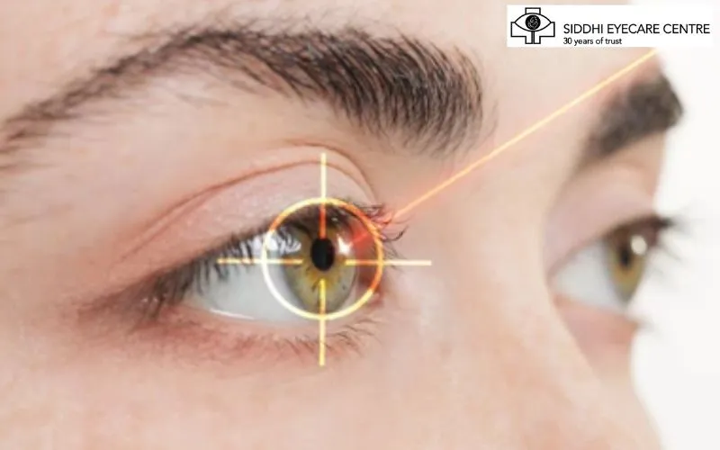 LASIK Eye Surgery in Bangalore