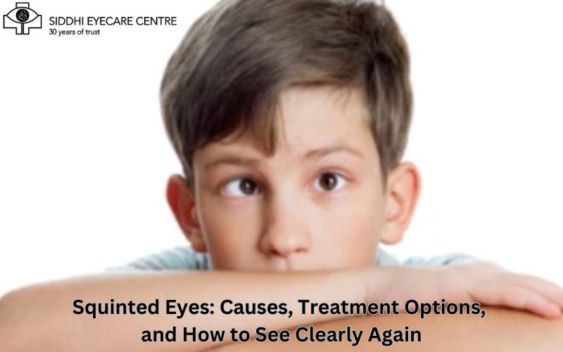 Squinty Eyes Treatment