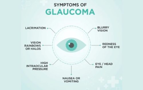 best glaucoma specialist in bangalore